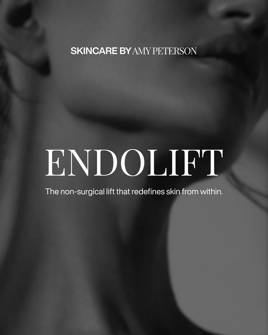 Endolift&reg; is where precision meets transformation. ✨

This minimally invasive laser treatment works beneath the skin to lift, tighten, and sculpt in a way that feels natural and refined. By stimulating collagen and gently remodeling tissue, Endol