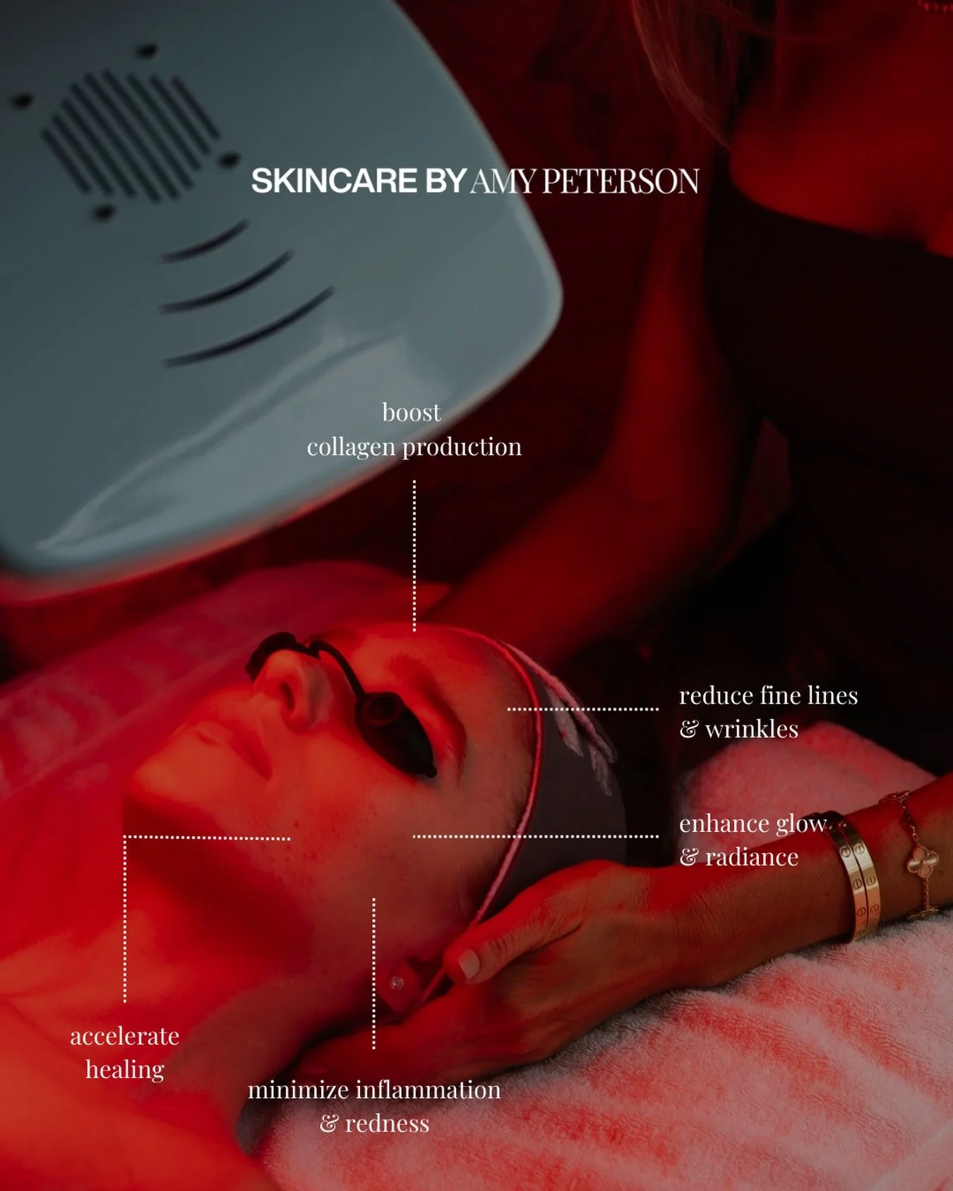 There&rsquo;s been a lot of talk about red light therapy on the internet lately... and for good reason.

This treatment uses clinically proven wavelengths of light to boost collagen production, calm inflammation, and enhance the skin&rsquo;s natural 