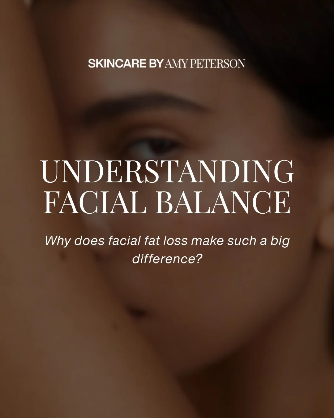 Facial balance is never about doing more.
 It&rsquo;s about understanding what&rsquo;s already there and restoring it thoughtfully.

An anatomy-first approach makes all the difference.
 Refined. Seamless. Natural.