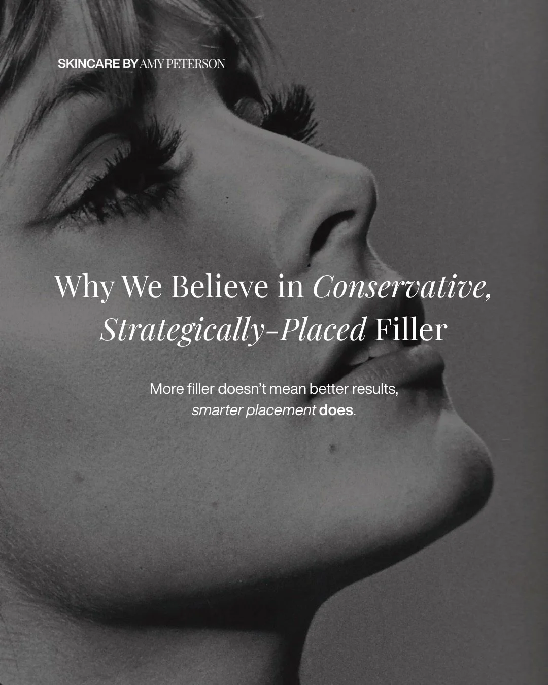 We&rsquo;re big believers in conservative, well-placed filler. Not to change your face, but to support it where it actually needs it.

When it&rsquo;s done right, people don&rsquo;t ask what you did. They just say you look rested, balanced, and like 