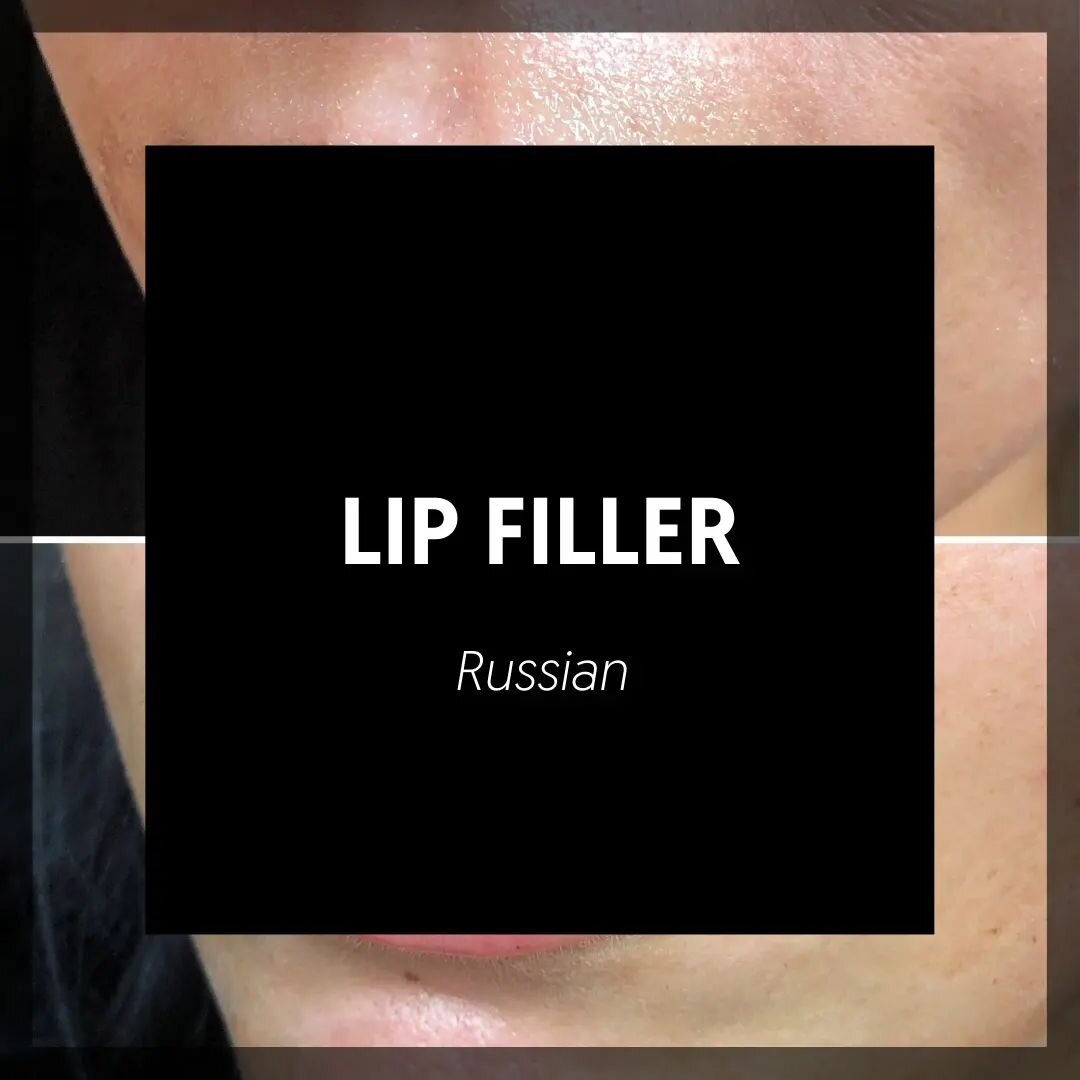 Russian Lip Filler
Results from just 1 session 💪