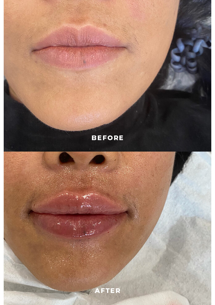SKIN before and afters2.jpg