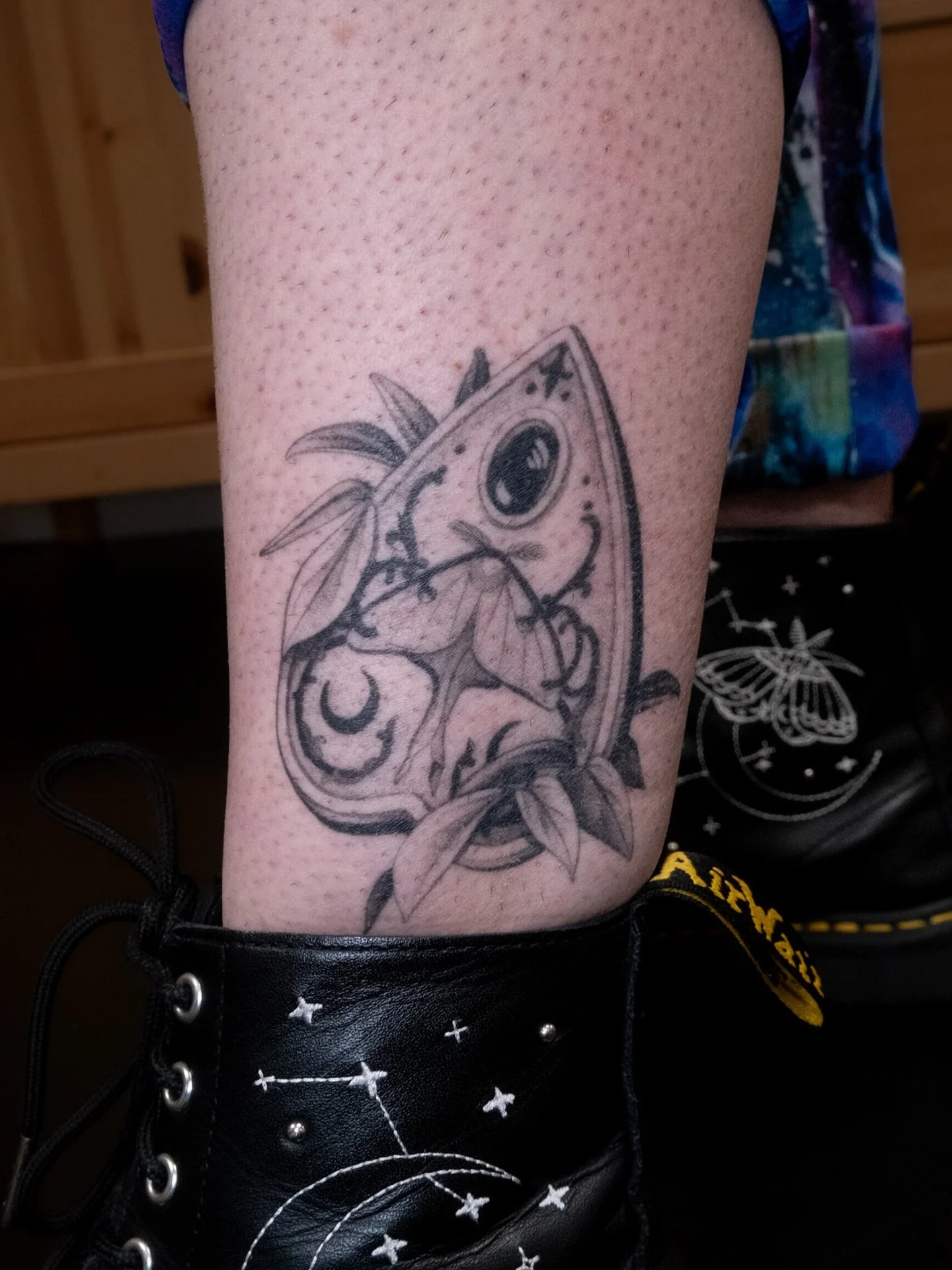 1 year minus 1 day healed! Special mention to the matching boots!! Thank you so much Liz ✧˖&deg;