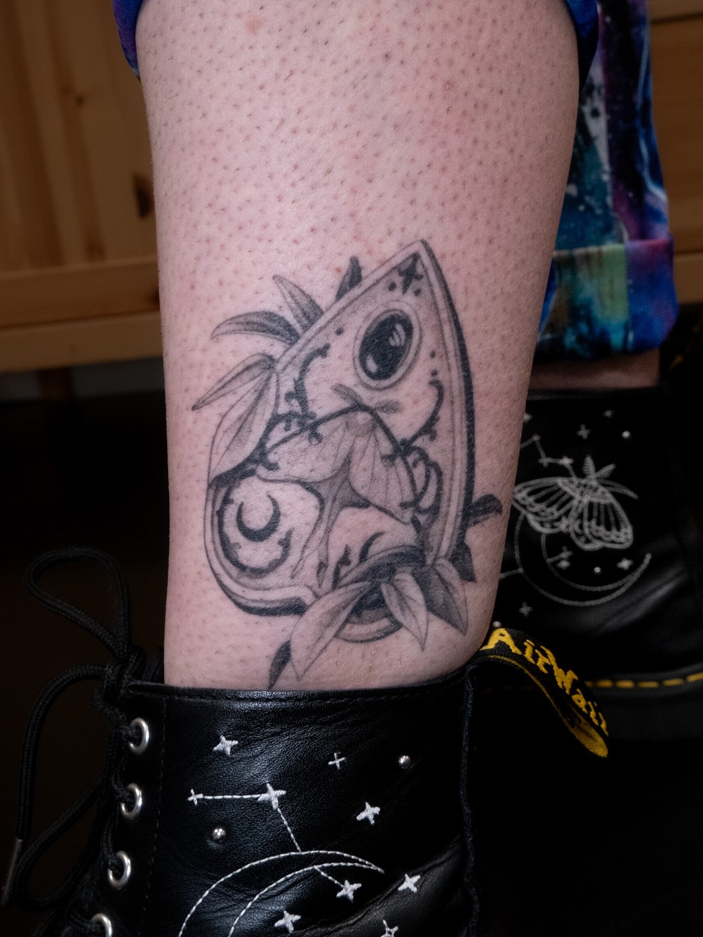1 year minus 1 day healed! Special mention to the matching boots!! Thank you so much Liz ✧˖&deg;