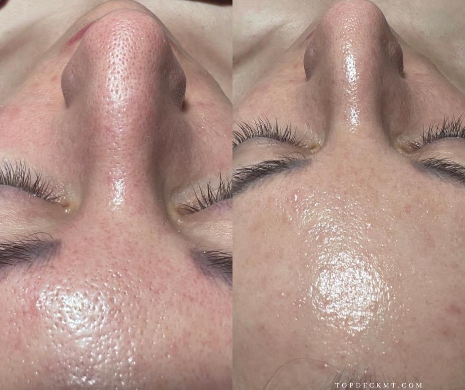 Before & After Photos — Top Deck Medical Aesthetics