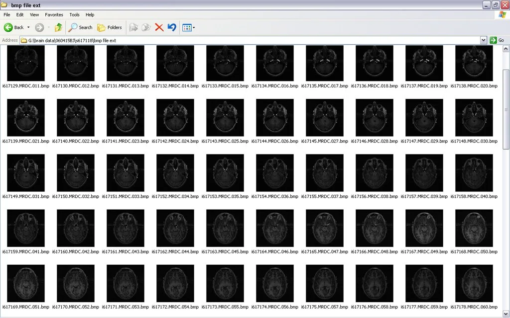 brainScanFolder.jpg