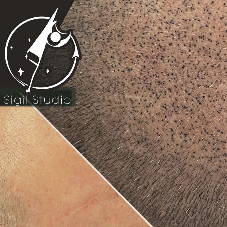 Details- that&rsquo;s what&rsquo;s up. 

Natural looking results are not an accident - and should be the standard. If that&rsquo;s what you want - that&rsquo;s what we provide!

SMP microdot tattoos create the look of real hair. Size, depth, placemen