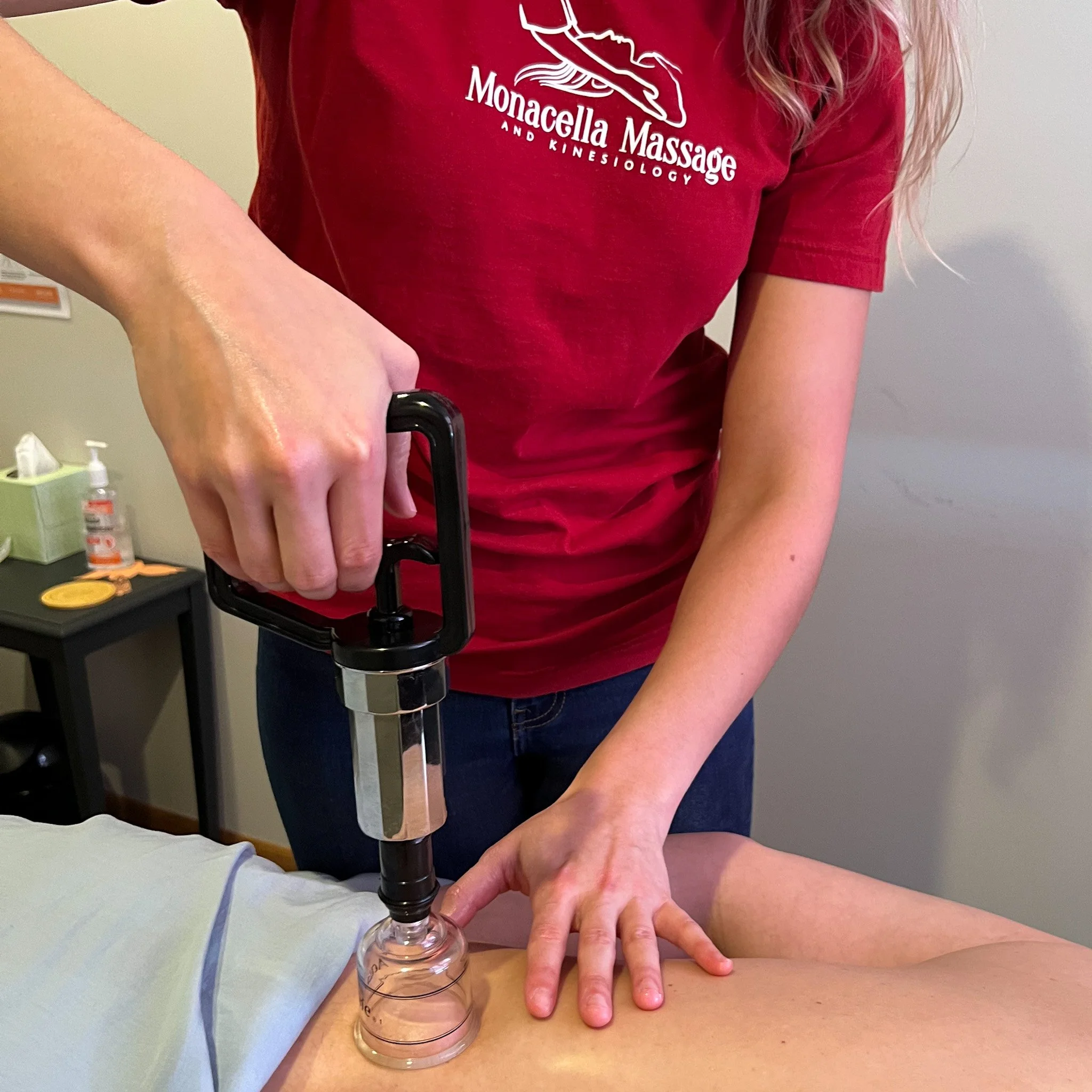 All about cupping — Monacella Massage & Kinesiology