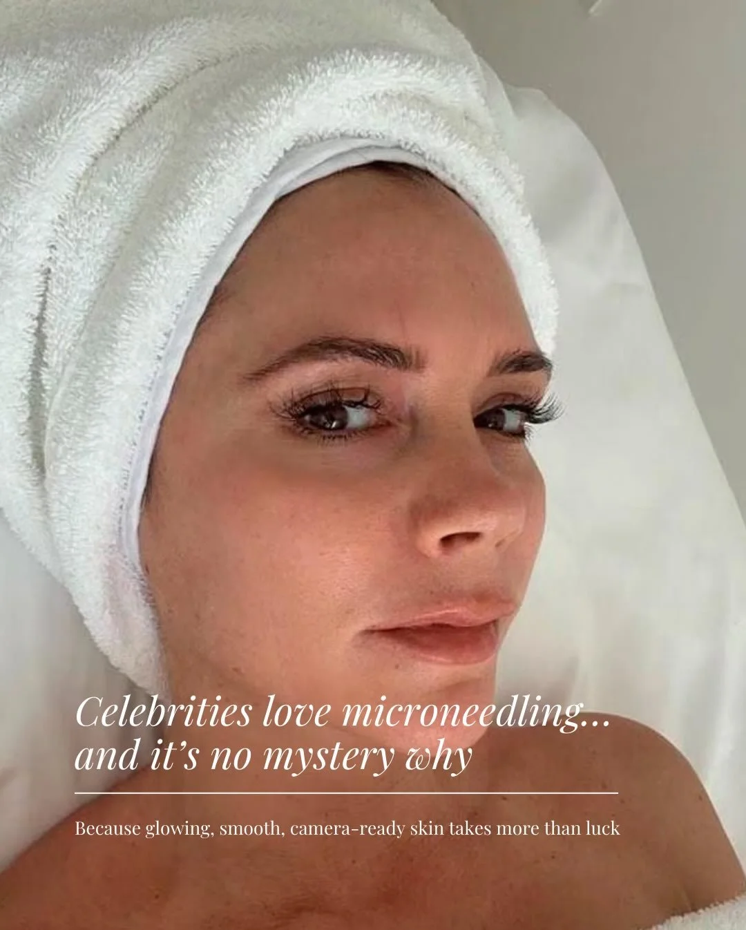 Pourquoi les c&eacute;l&eacute;brit&eacute;s jurent par le microneedling? ✨
Glow naturel. Texture liss&eacute;e. R&eacute;sultats incroyables.

Envie du m&ecirc;me r&eacute;sultat (sans les filtres)? R&eacute;serve une consultation avec nous d&egrave