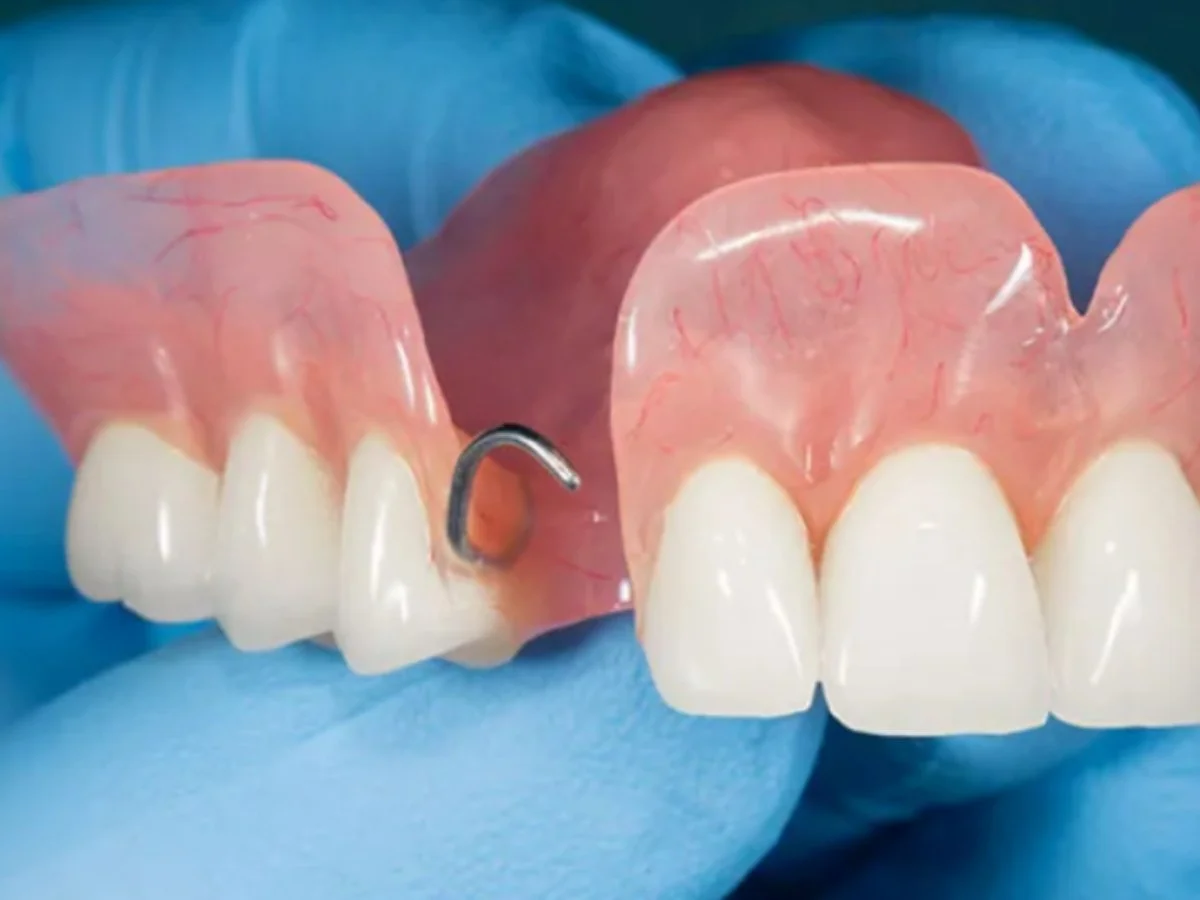 Common Problems with Dentures and How to Fix Them