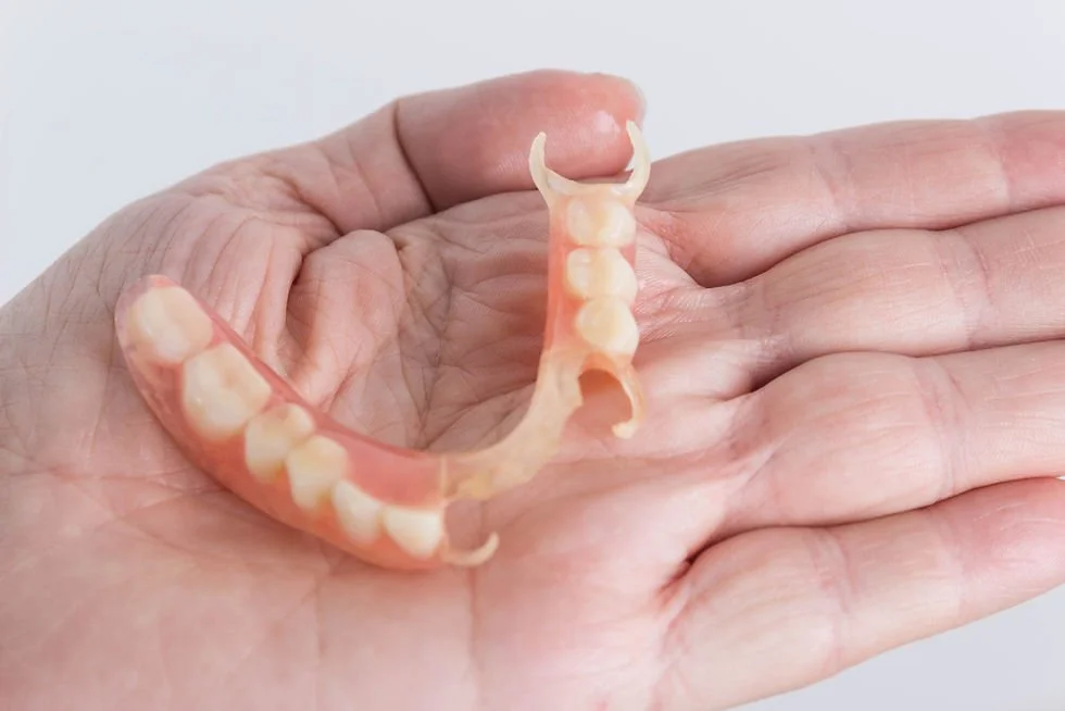 Types of Upper Partial Dentures and How Each Option Works