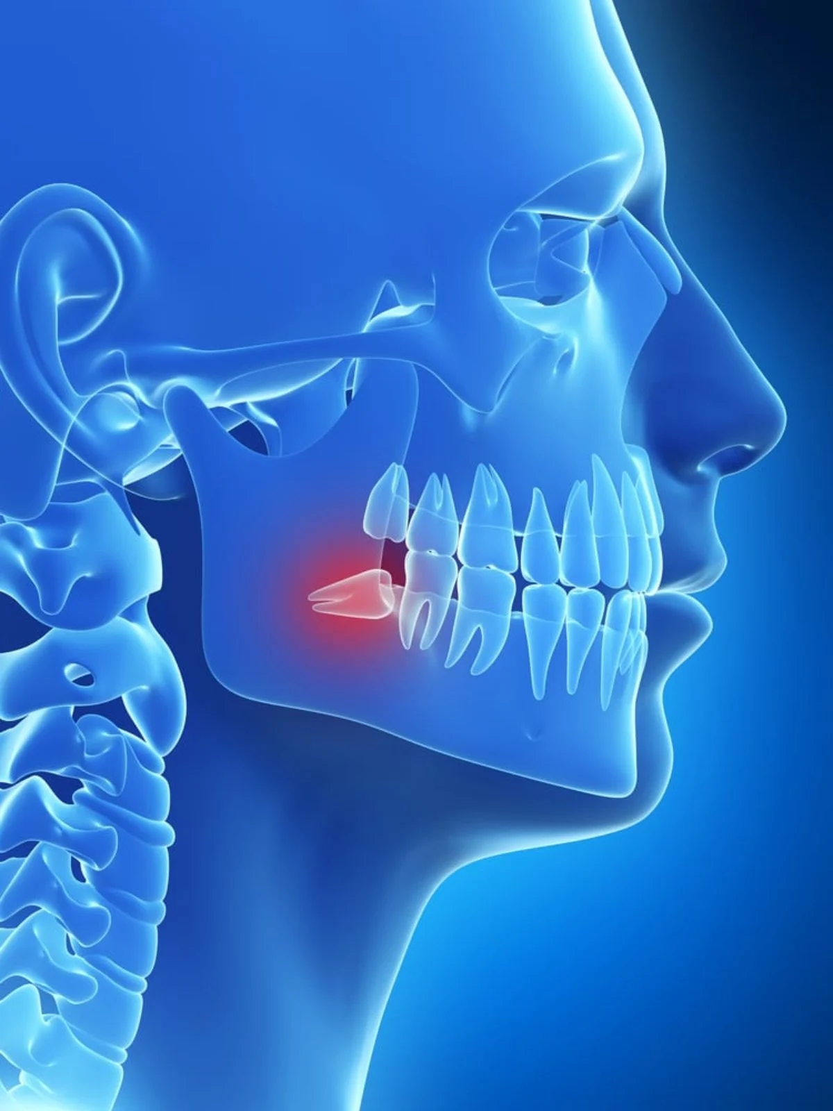 How Painful Is Wisdom Tooth Extraction