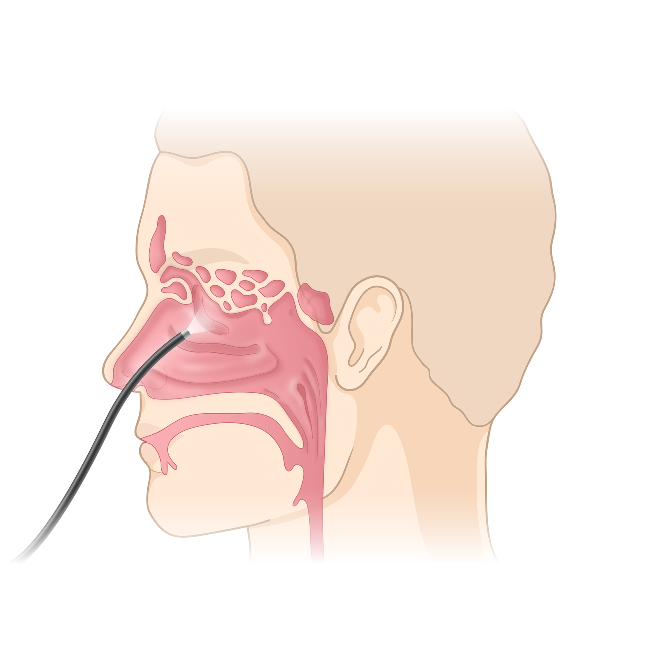 Sinuses