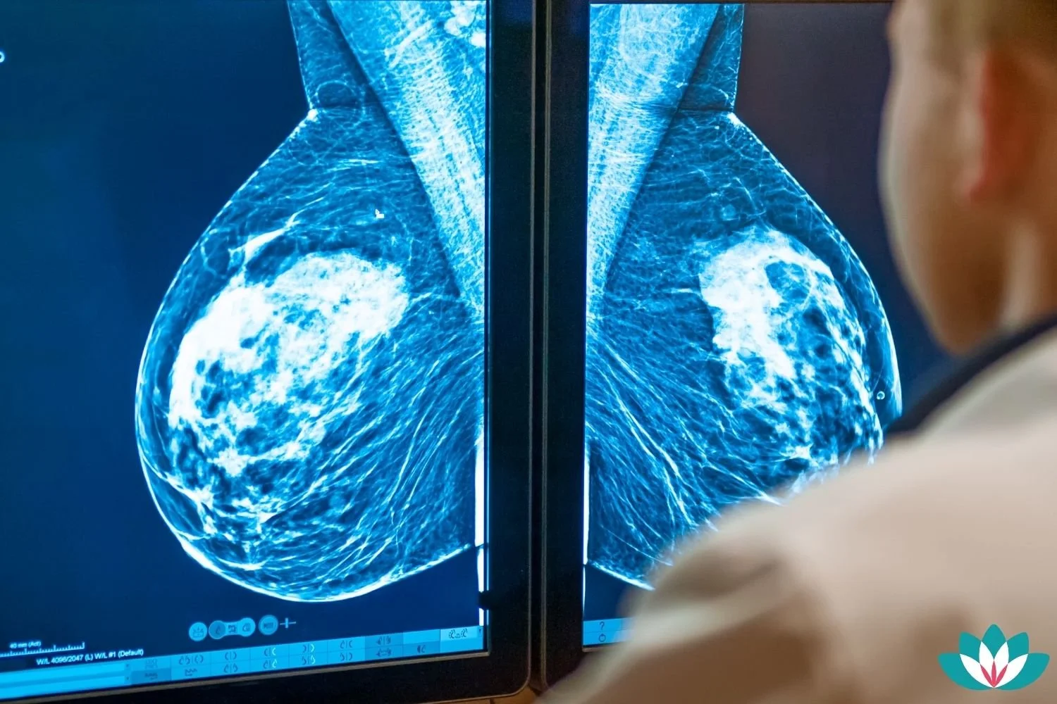 5 Things You Can Expect During An MRI Scan to Screen for Breast Cancer