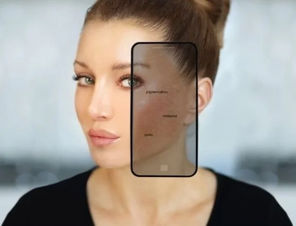 A women with hyperpigmentation, melasma, and spots.