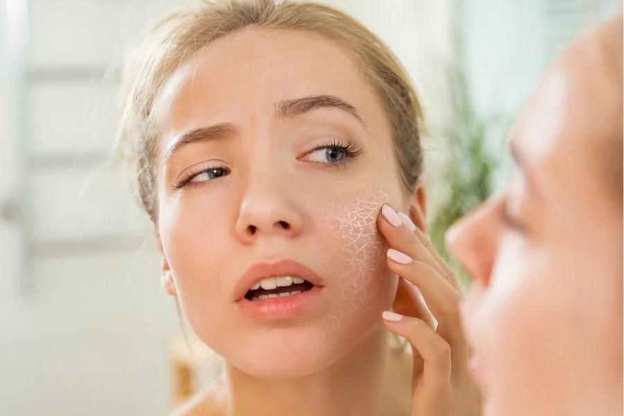 A woman looking at her dry, flaking skin in a mirror.