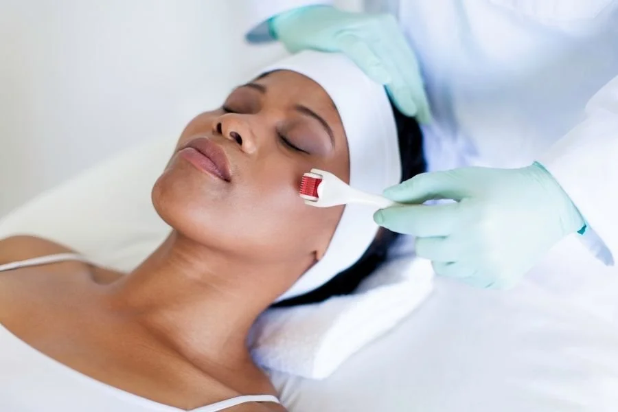 A woman of colour lying on a medical spa table, being microneedled with a derma roller.