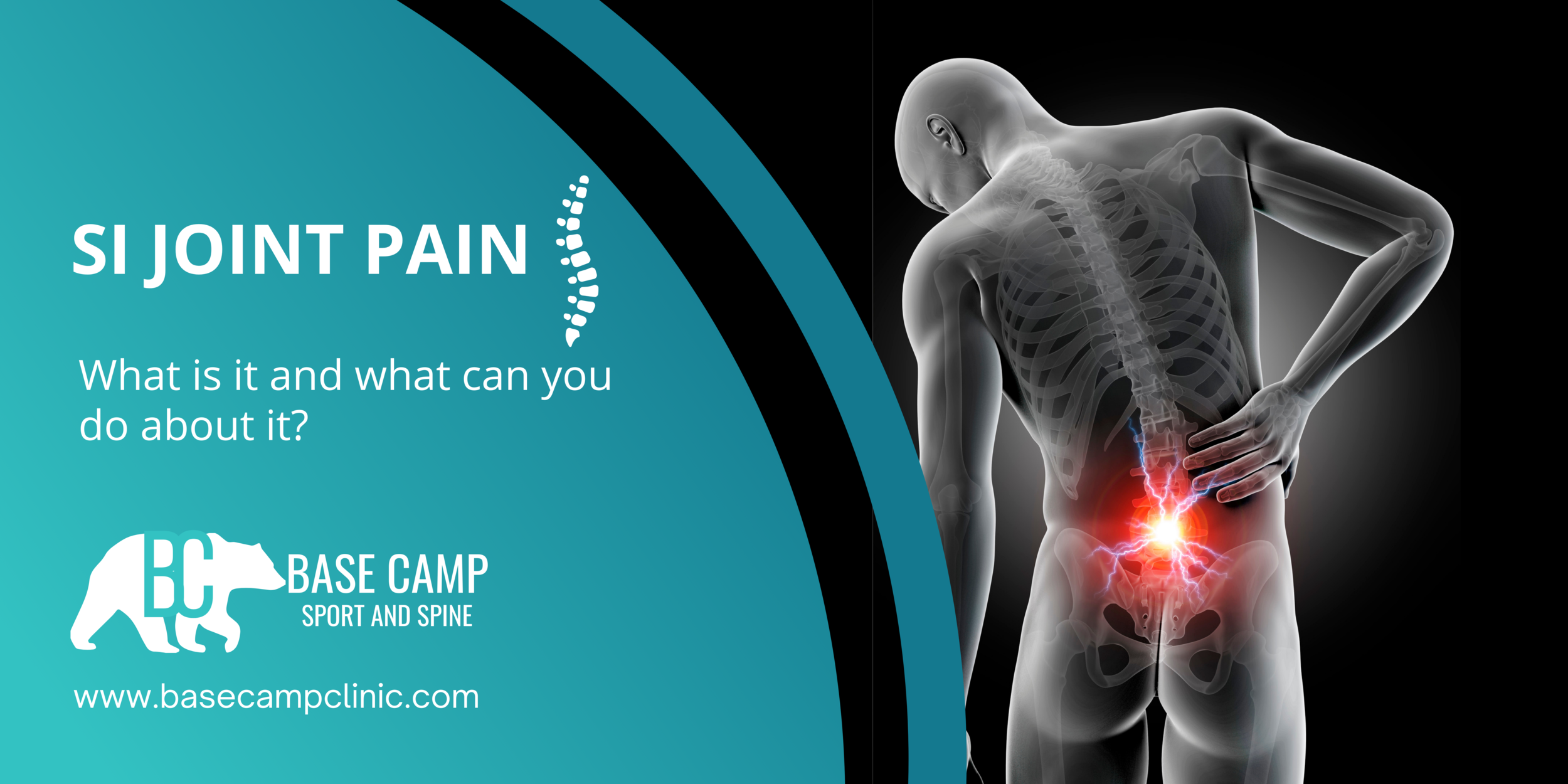 SI Joint Pain - What is it? — Base Camp Chiropractic & Sports Rehab