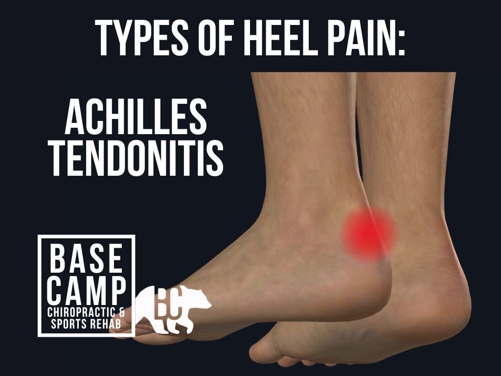 What are the Conditions Related to Heel Pain in Dallas, Texas -  Neighborhood Medical Center