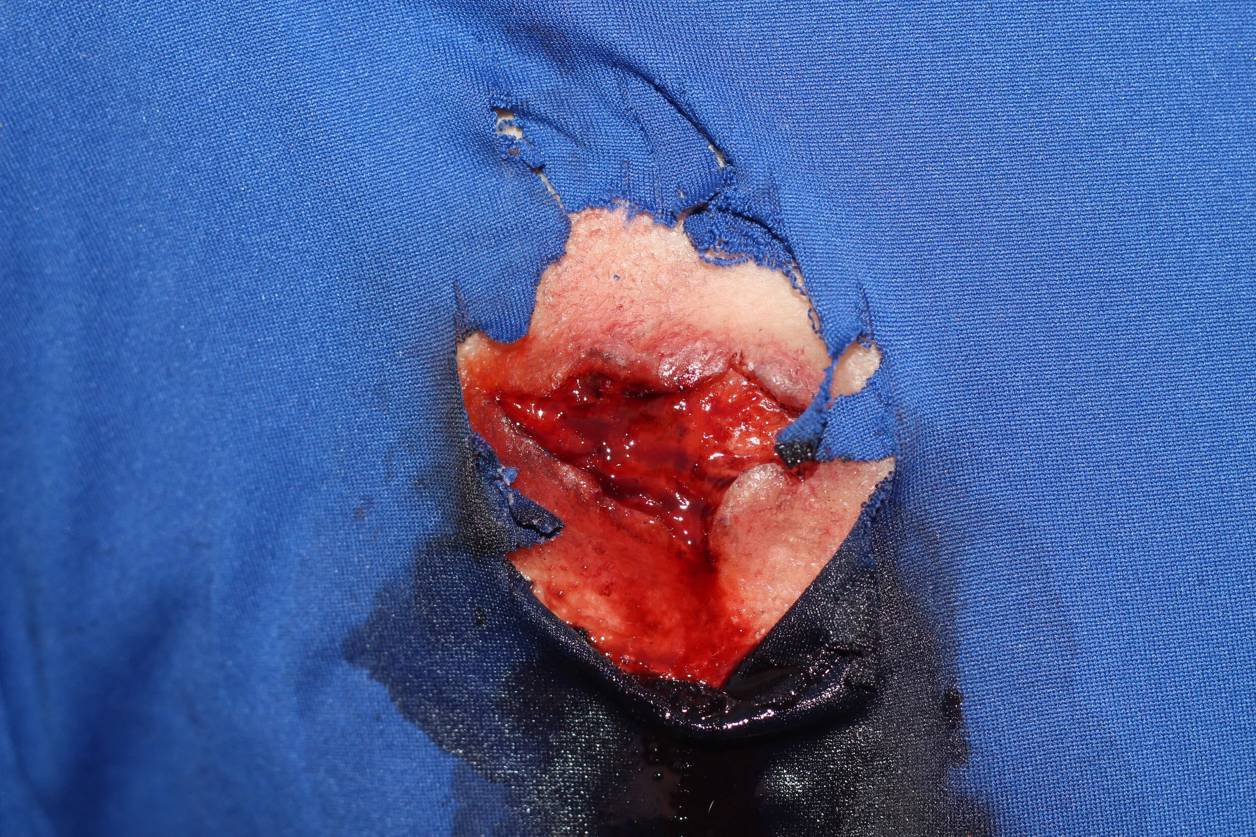 ZOMBIE BULLET WOUND.JPG