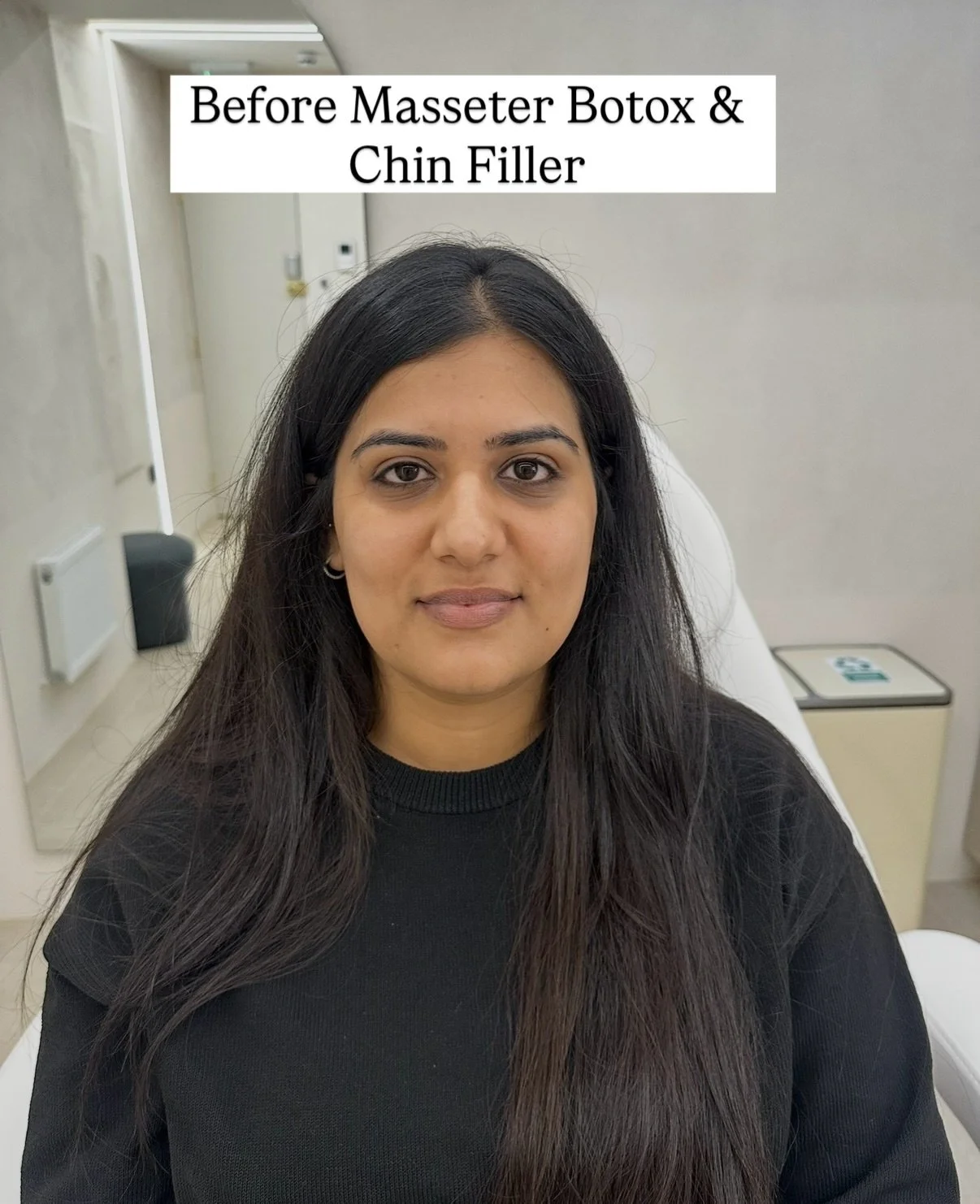 Dreaming of a slimmer, more contoured face? 💫

By targeting the masseter muscles, we can soften a strong or square jawline for a more delicate, tapered shape. Perfect for anyone looking to reduce jaw bulk caused by clenching or grinding, this treatm