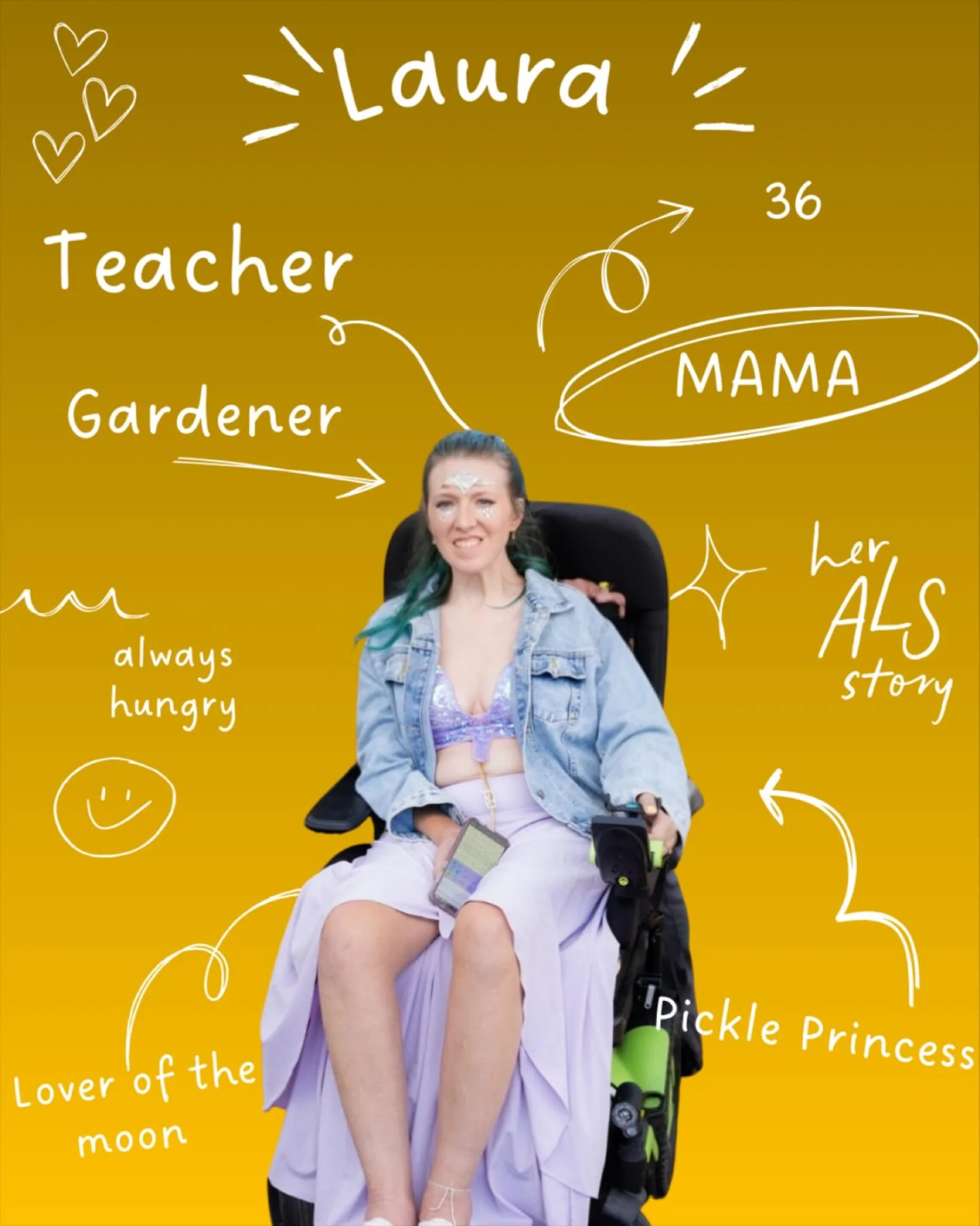 Meet our members!

#ALSAwareness #EndALS #HerALSStory ALS LifeWithALS Accessibility Disability MND MotorNeuroDisease ALSSucks MNDAwareness FuckMND DisabilityAwarenesss accessibility babewithamobilityaid