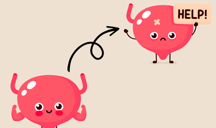 Bladder Pain Syndrome/Interstitial Cystitis