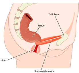 The Pelvic Floor and Puborectalis: Unraveling Their Role in Constipation