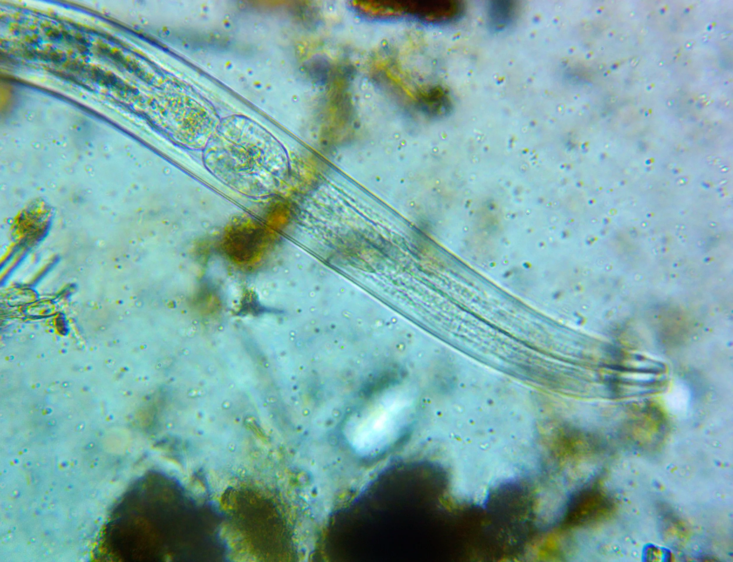 Bacterial feeder.jpg