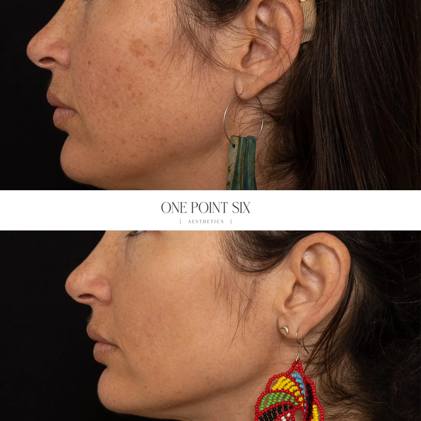 IPL B&A Melissa.jpg