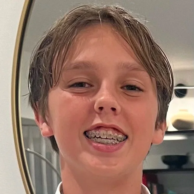 Eddie Skolarus