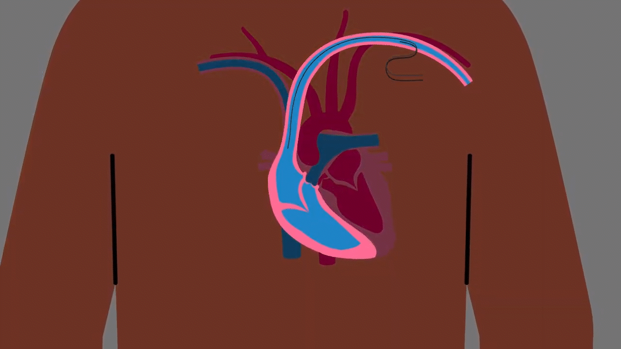 Animated medical illustration showing the human heart and major blood vessels inside the chest