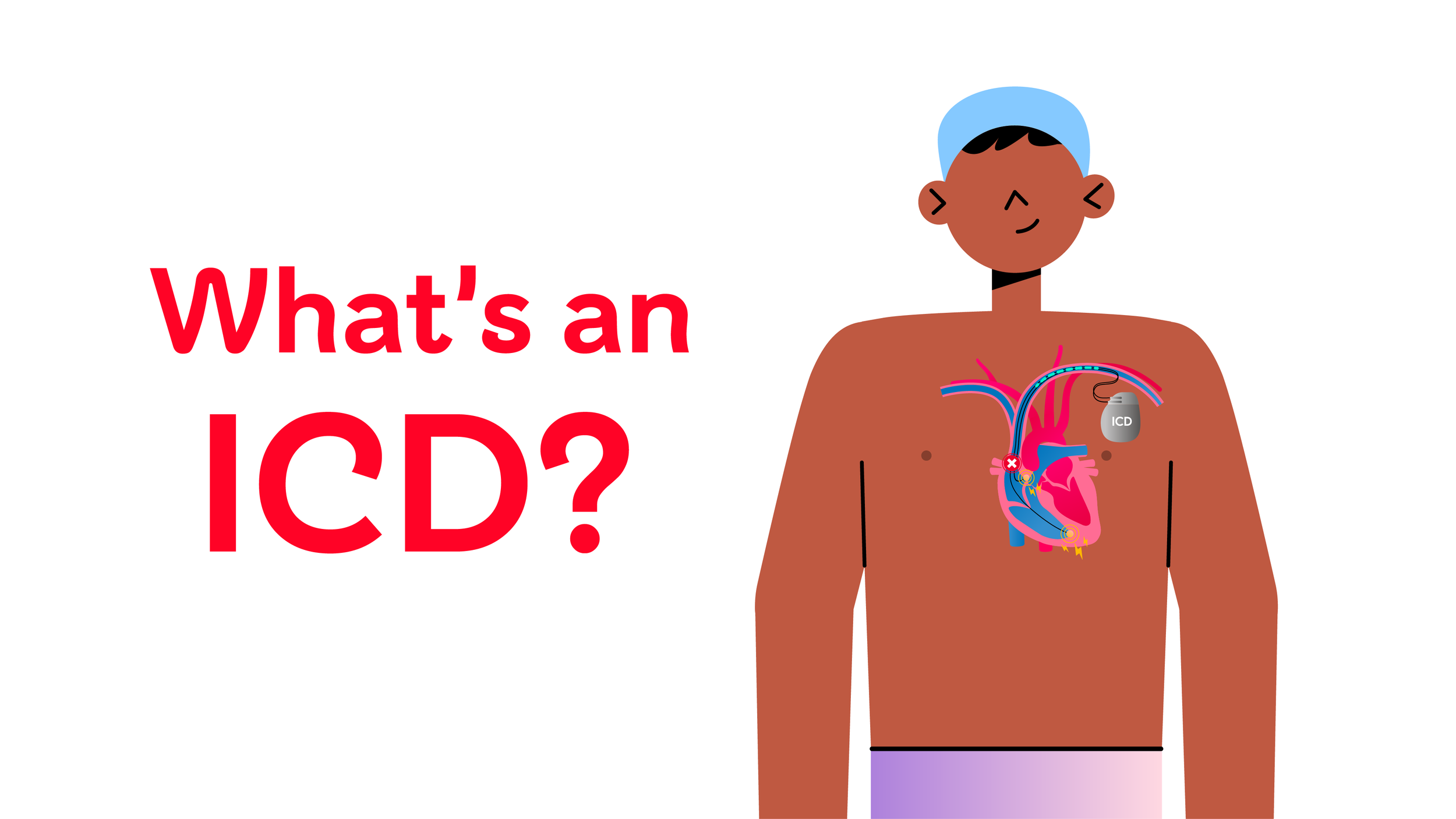 British Heart Foundation ICD animation title card, "What's an ICD?"