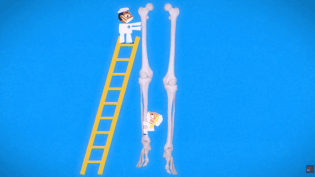 Medical workers compare leg bones using a ladder against a blue background.