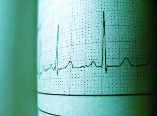 Heart Rate Reserve: A Simple, Safe Way To Test Your Cardiorespiratory Fitness