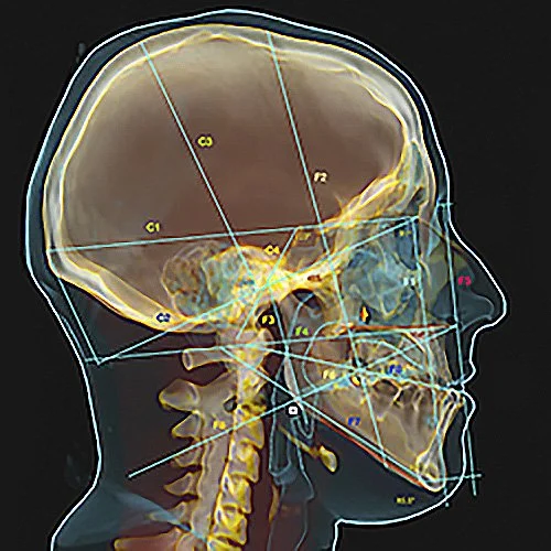 ANÁLISIS DE DELAIRE.jpg