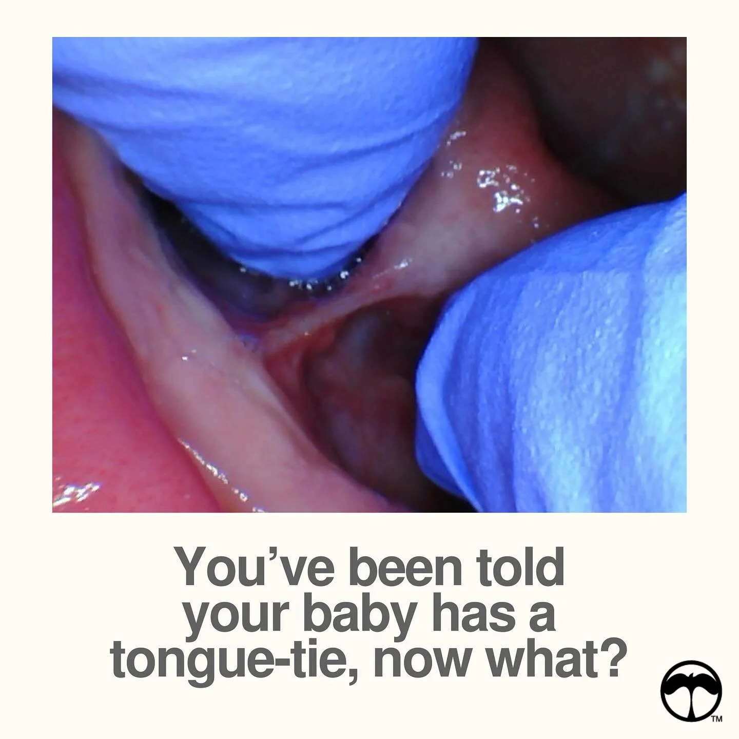 Hearing your baby has a tongue-tie can feel overwhelming &mdash; but you don&rsquo;t have to figure it out alone. The early steps you take can make all the difference. 

My second upcoming course is designed to guide parents like you through every st