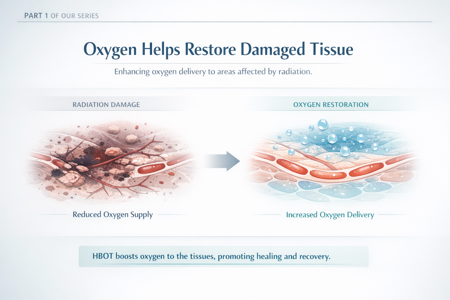 Oxygen Restores Damaged Tissue
