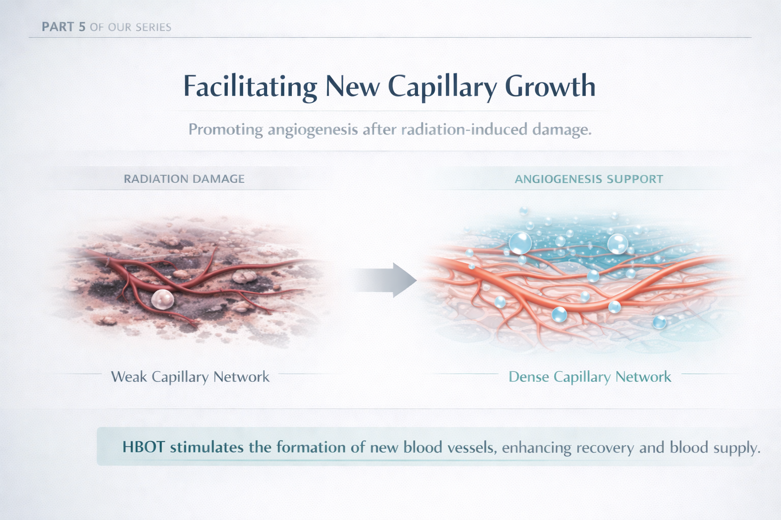 New Capillary Growth