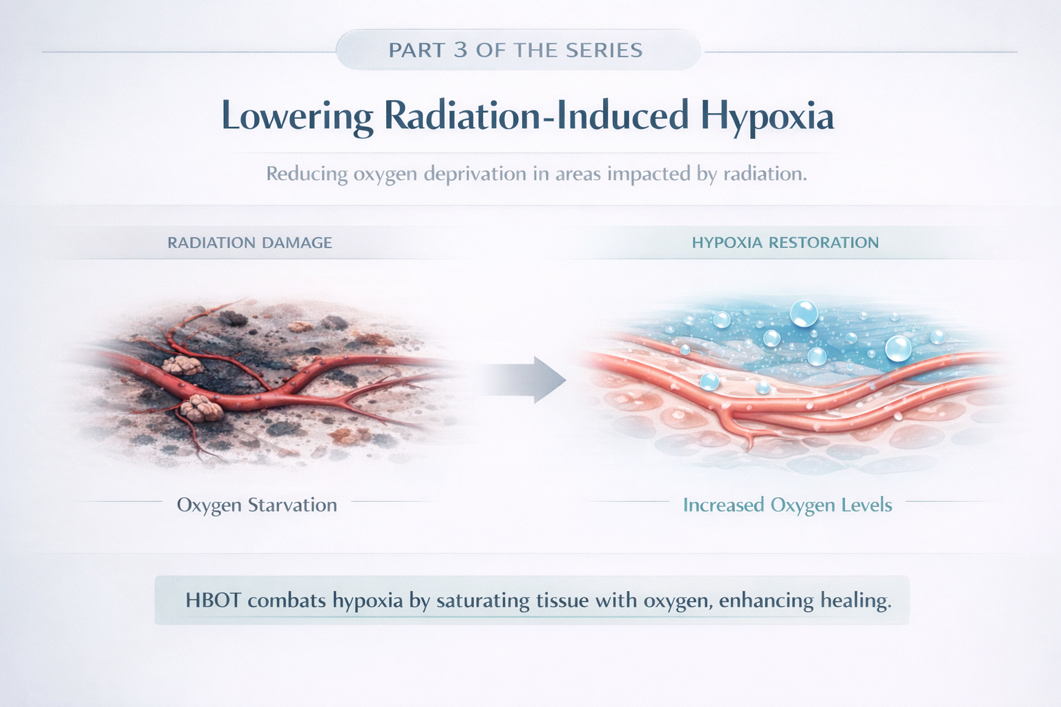 Lowering Radiation Induced Hypoxia 