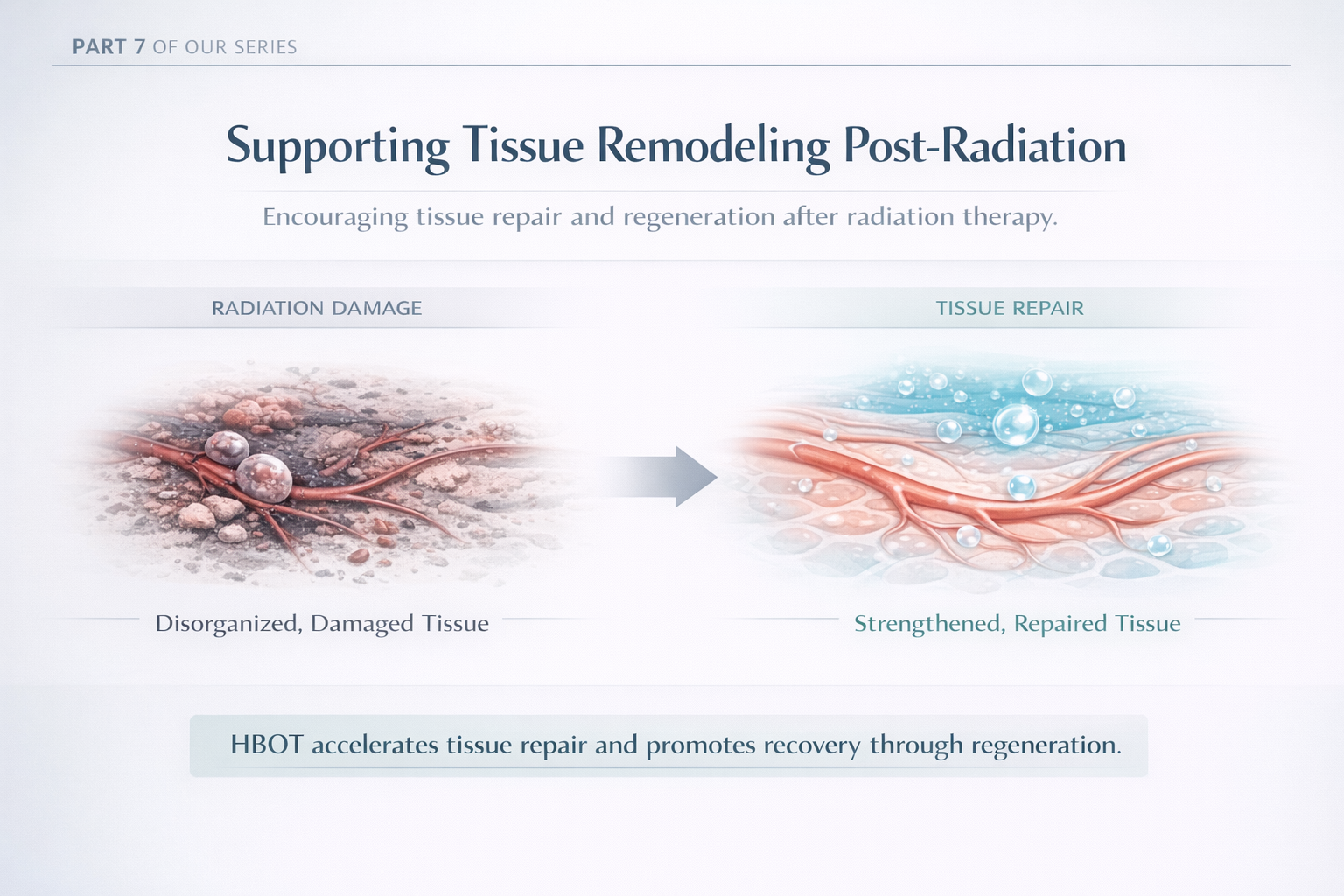 Tissue Remodelling