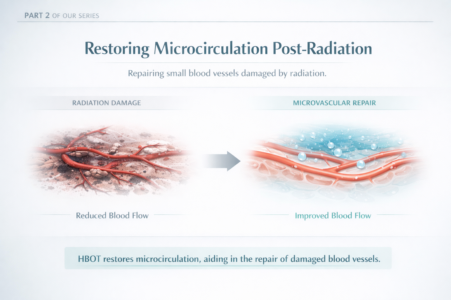 Restoring Microcirculation Post Radiation