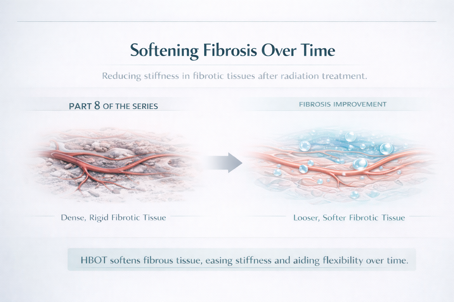 Fibrosis