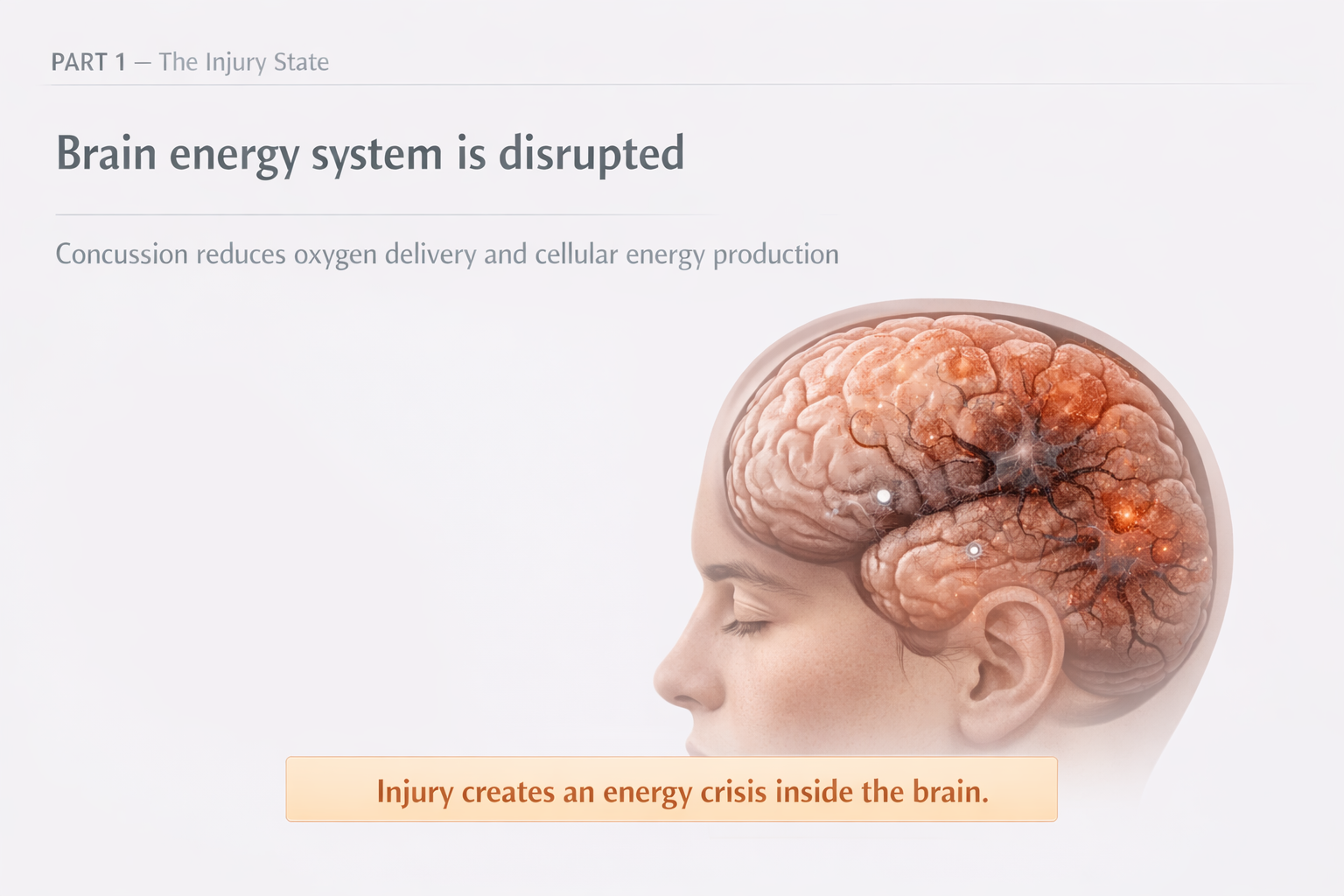 Brain energy system is disrupted