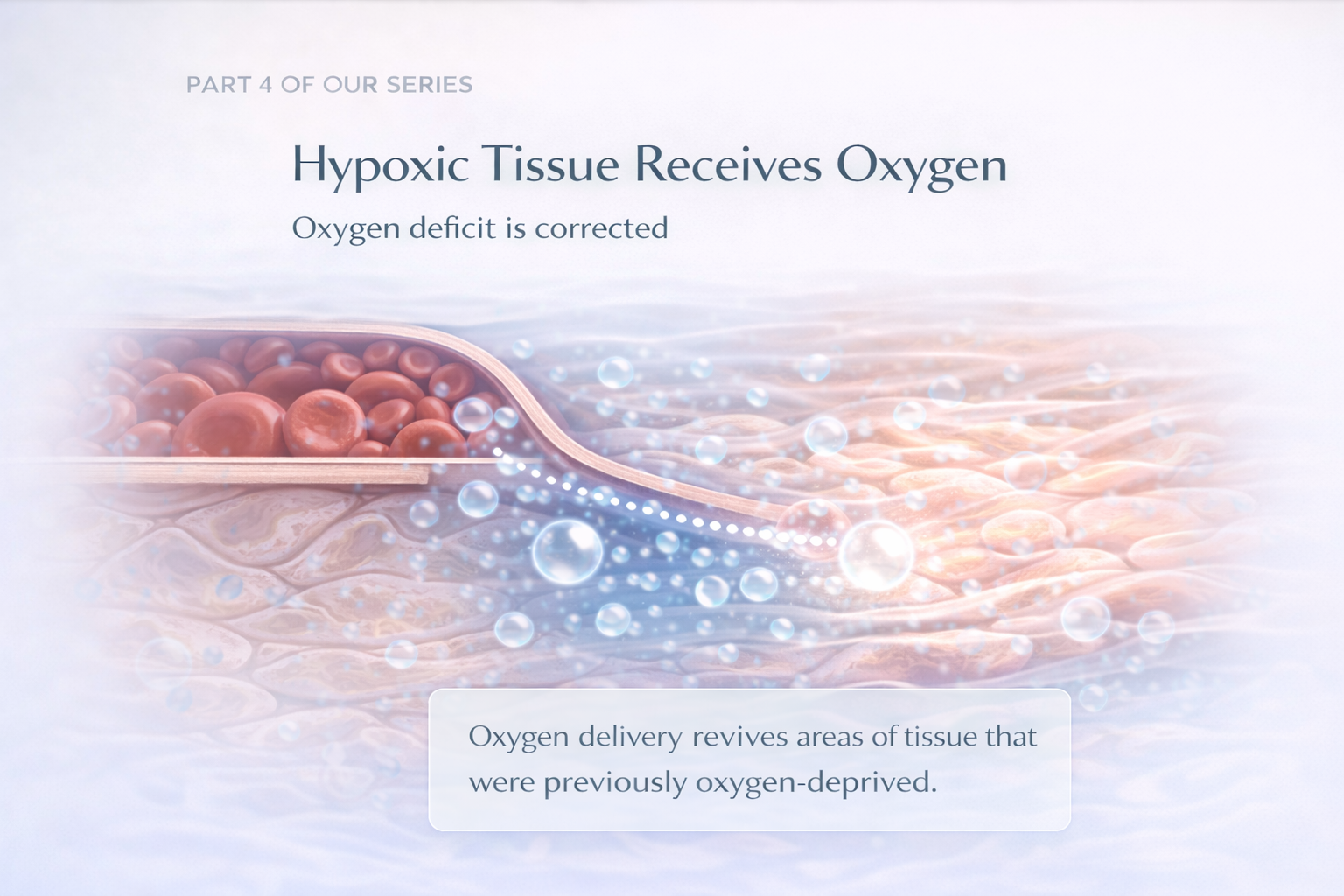 Hypoxic Tissues Receives Oxygen