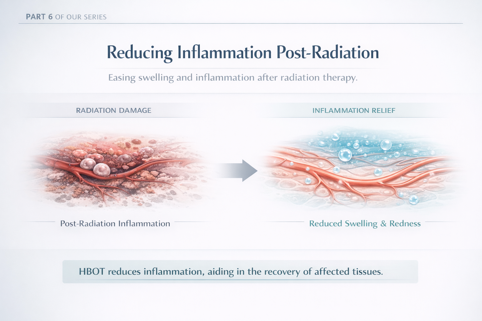 Reducing Inflammation