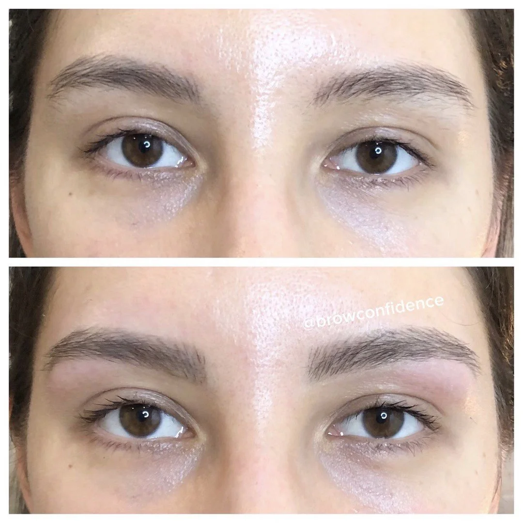 A perfect example of how a 30-minute #BCTransformation⁣ can feel like a brow lift.

Brow shaping shouldn't be just about getting rid of stray hairs. It's about improving the overall structure and shape so that they look even fuller once hairs are rem
