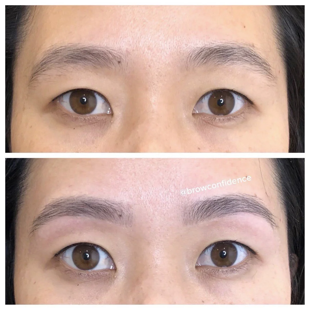Bringing back a classic #browconfidence shaping to show how it brings balance to the face

In this #BCtransformation, I brought the starting point of her brows inward by about 2mm to elongate the brow and create a more pronounced arch point.

I remov
