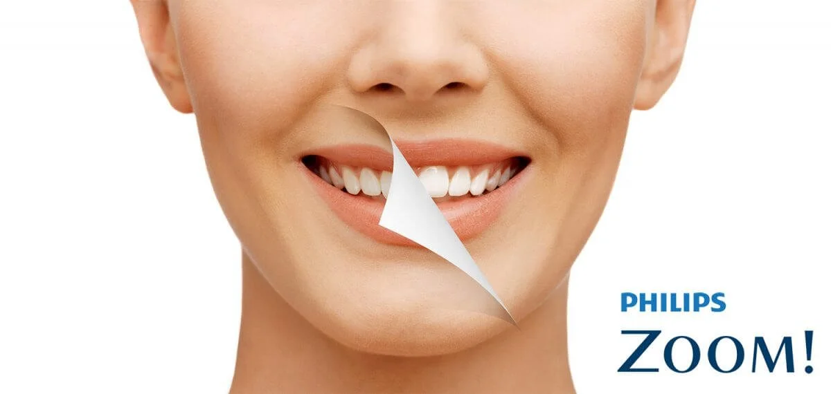 Get a Brighter, Whiter Smile This Festive Season – Philips Zoom Whitening Now Only R3500 at De Necker Dentistry George!