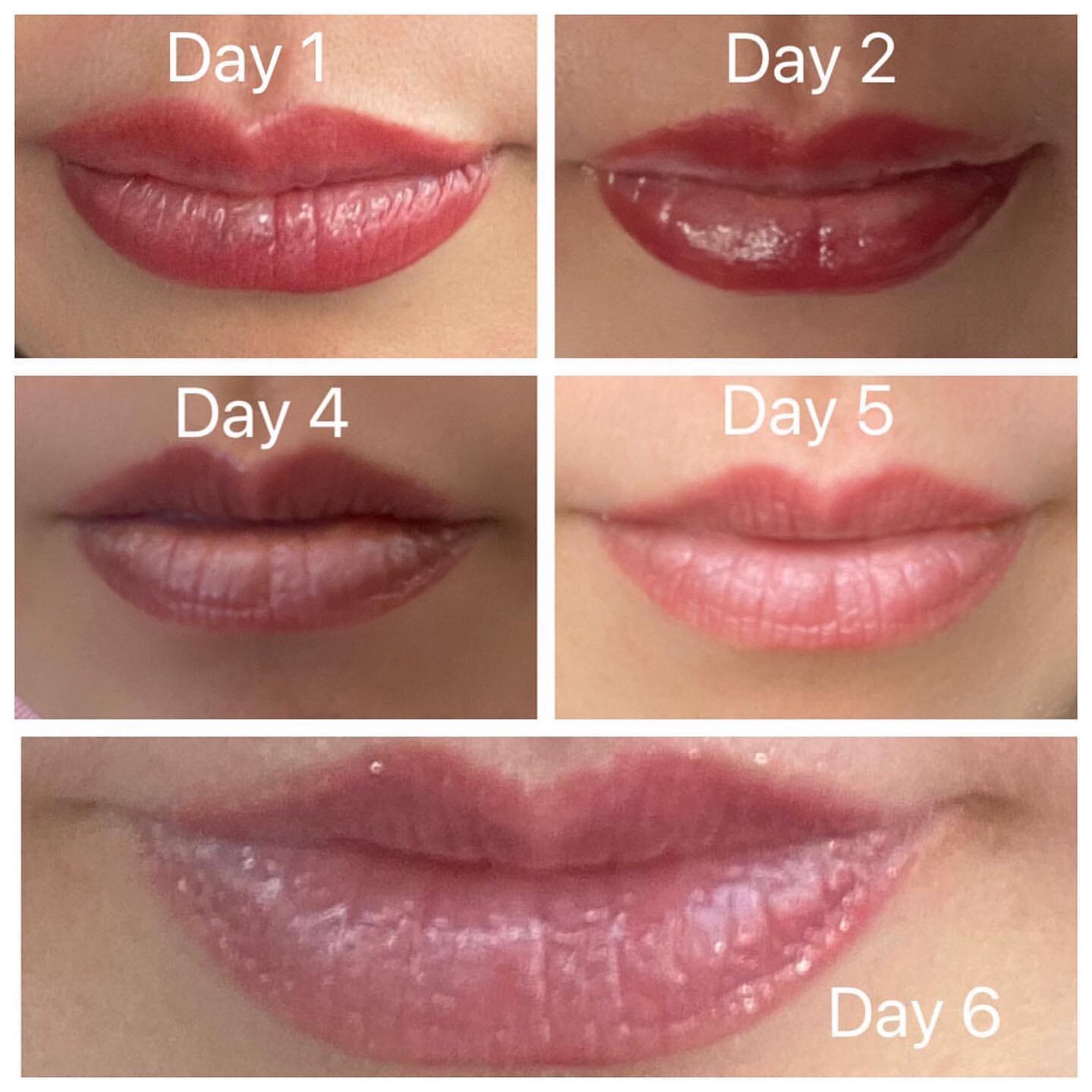 L I P  B L U S H
A huge thank you to my awesome client @sundayrose99 for taking these pictures and sharing them with me!!

Give your lips 4-8 weeks after the initial colour flakes off for the colour to bloom (the pigment will rise and encapsulate clo